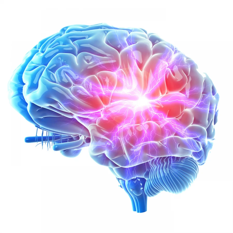 3d,Rendered,,Medically,Accurate,Illustration,Of,A,Painful,Brain