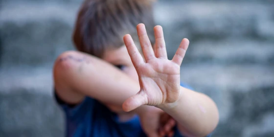 Children,Violence,And,Abused,Concept.,Child,Raising,Hands,To,Protect